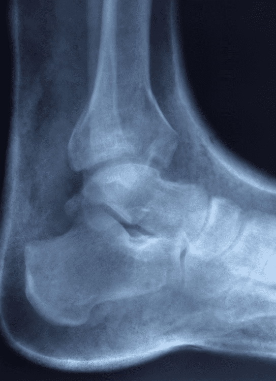 Servicios de ortopedia_Prótesis y OrtesisServicios de ortopedia_Radiología e Imágenes3