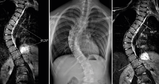 Servicios de ortopedia_Prótesis y OrtesisServicios de ortopedia_Radiología e Imágenes4